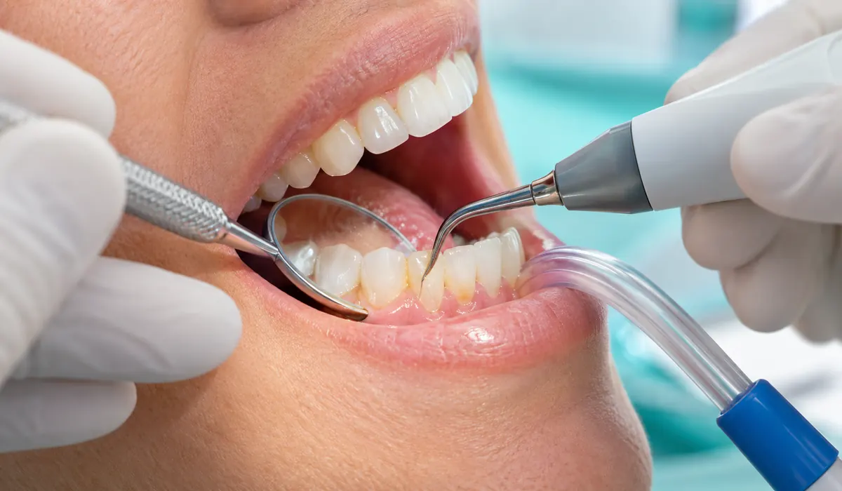 Limpieza dental profesional con instrumento de ultrasonido, espejo bucal y aspiración.